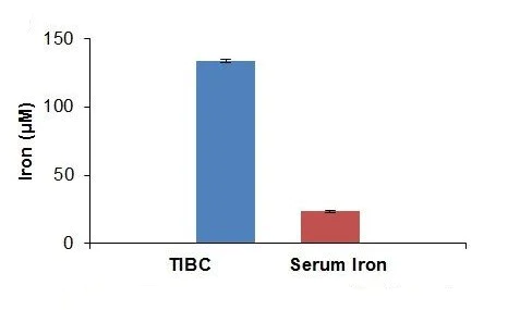 abcam Total Iron-Binding Capacity (TIBC) and Serum Iron Assay Kit