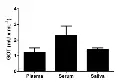 abcam Aspartate Aminotransferase Activity Assay Kit