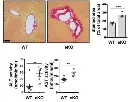 abcam Aspartate Aminotransferase Activity Assay Kit